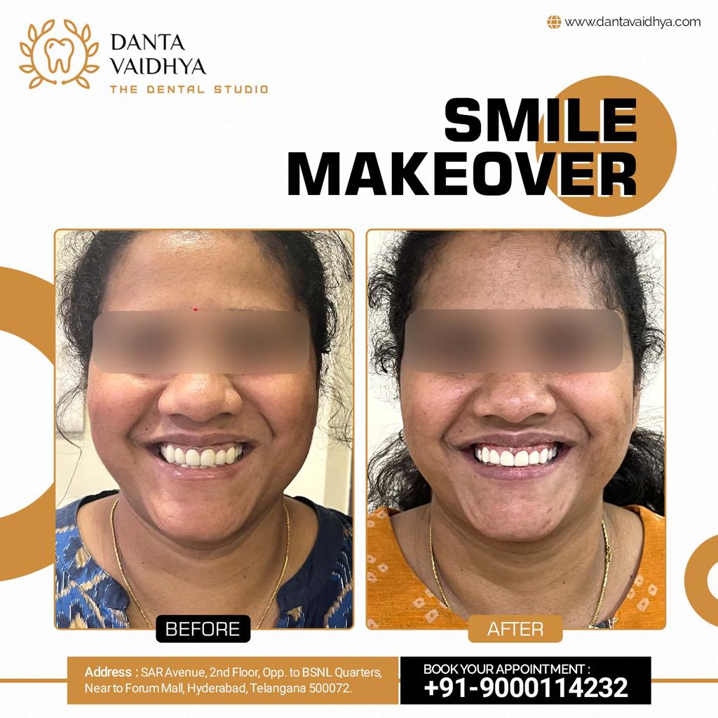 WhatsApp Image 2023-08-13 at 19.32.14